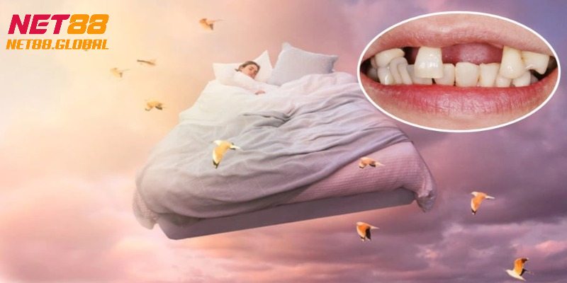 Mơ bị rụng rất nhiều răng hàm